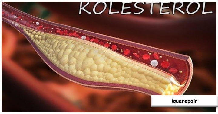 Obat Kolesterol yang Ampuh, Pilihan Medis dan Alami untuk Kesehatan Jantung